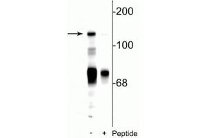 Western blot of rat cerebellar lysate showing specific immunolabeling of the ~140 kDa NR2C subunit of the NMDA receptor phosphorylated at Ser1244 in the first lane (-). (GRIN2C antibody  (pSer1244))