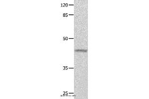 Western blot analysis of Mouse eyes tissue, using GNA11 Polyclonal Antibody at dilution of 1:550 (GNA11 antibody)