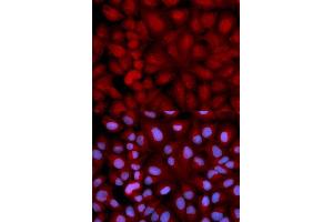 Immunofluorescence analysis of U2OS cell using SNCG antibody. (SNCG antibody  (AA 1-127))