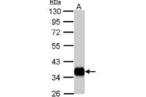 WB Image Pyruvate Dehydrogenase E1 beta subunit antibody detects PDHB protein by Western blot analysis. (PDHE1-B antibody)