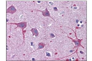 Human Brain, Cortex: Formalin-Fixed, Paraffin-Embedded (FFPE) (SKA1 antibody  (C-Term))