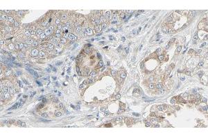 ABIN6268943 at 1/100 staining Human prostate tissue by IHC-P. (TRAF1 antibody  (C-Term))