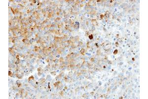 IHC-P Image Immunohistochemical analysis of paraffin-embedded H1299 xenograft, using HIP55, antibody at 1:100 dilution. (DBNL antibody  (N-Term))
