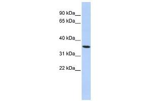 PAQR6 antibody used at 1 ug/ml to detect target protein. (PAQR6 antibody  (N-Term))