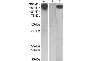HEK293 lysate (10ug protein in RIPA buffer) overexpressing Human CSF1R with C-terminal MYC tag probed with ABIN571221 (0. (CSF1R antibody  (AA 700-710))