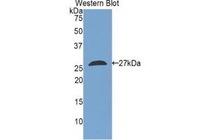 Detection of Recombinant TAZ, Rat using Polyclonal Antibody to Tafazzin (TAZ) (TAZ antibody  (AA 46-239))