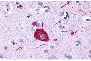 Anti-GPR116 antibody  ABIN1048696 IHC staining of human brain, neuron.