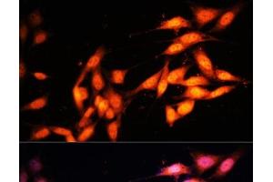Immunofluorescence (IF) image for anti-K(lysine) Acetyltransferase 2A (KAT2A) antibody (ABIN7260323)