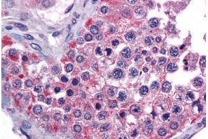 Human Testis: Formalin-Fixed, Paraffin-Embedded (FFPE) (MIA3 antibody  (AA 1-120))