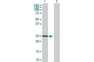 Western Blot analysis of ARHGDIB expression in transfected 293T cell line by ARHGDIB MaxPab polyclonal antibody. (ARHGDIB antibody  (AA 1-201))