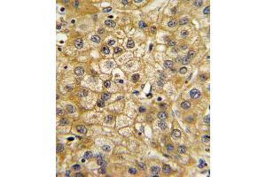 Immunohistochemistry (IHC) image for anti-Adiponectin Receptor 1 (ADIPOR1) antibody (ABIN3003843) (Adiponectin Receptor 1 antibody)