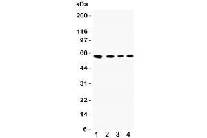 Western blot testing of CADM1 antibody and Lane 1:  A549;  2: Jurkat;  3: Raji;  4: HeLa lysate.