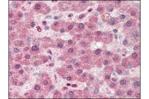 Image no. 1 for anti-Pyruvate Carboxylase (PC) (Internal Region) antibody (ABIN372799) (PC antibody  (Internal Region))
