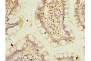 Immunohistochemistry of paraffin-embedded human small intestine tissue using ABIN7165942 at dilution of 1:100 (PPM1D antibody  (AA 1-250))