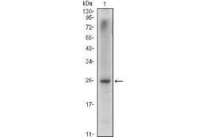 Western Blot showing NKX3A antibody used against LNCaP (1) cell lysate. (NKX3-1 antibody)