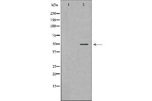 Western blot analysis of extracts of HeLa, using PLAU antibody. (PLAU antibody)