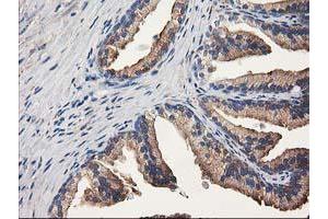 Immunohistochemistry (IHC) image for anti-Aldehyde Dehydrogenase 1 Family, Member A3 (ALDH1A3) (AA 1-100), (AA 413-512) antibody (ABIN2715886) (ALDH1A3 antibody  (AA 1-100, AA 413-512))