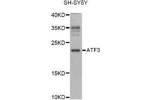 Western blot analysis of extracts of SH-SY5Y cells, using ATF3 antibody (ABIN6290025) at 1:1000 dilution.