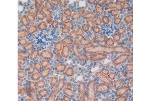 IHC-P analysis of kidney tissue, with DAB staining. (Vip antibody  (AA 34-157))