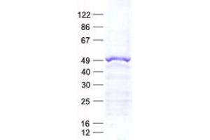 Validation with Western Blot (LCAT Protein (His tag))