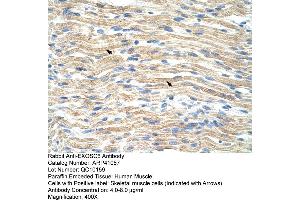 Rabbit Anti-EXOSC6 Antibody  Paraffin Embedded Tissue: Human Muscle Cellular Data: Skeletal muscle cells Antibody Concentration: 4. (EXOSC6 antibody  (N-Term))