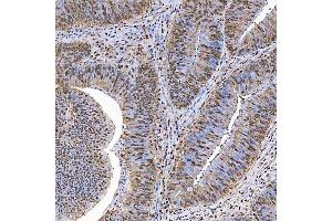 IHC analysis of SART1 using anti-SART1 antibody (ABIN7599884). (SART1 antibody  (AA 125-800))
