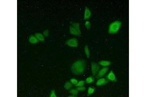 IHC-P analysis of HeLa cells, with FITC staining.