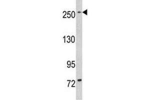 Western blot analysis of LRRK1 in mouse bladder tissue lysate (LRRK1 antibody  (AA 1981-2015))