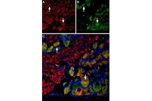 Multiplex staining of VGLUT2 and Neurokinin 1 Receptor in rat DRG - Immunohistochemical staining of perfusion-fixed frozen rat dorsal root ganglion (DRG) sections using Anti-VGLUT2-ATTO Fluor-594 Antibody (ABIN7043682), (1:60) and Anti-Neurokinin 1 Receptor (NK1R) (extracellular)-ATTO Fluor-488 Antibody (ABIN7043804), (1:60).