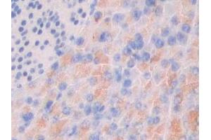 Detection of MUC3 in Human Pancreas Tissue using Polyclonal Antibody to Mucin 3 (MUC3)