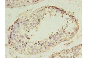 Immunohistochemistry of paraffin-embedded human testis tissue using ABIN7170468 at dilution of 1:100 (SPANXD antibody  (AA 1-97))