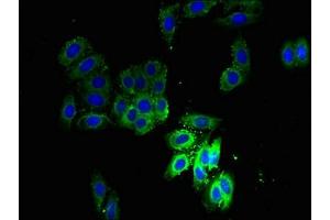 Immunofluorescent analysis of HepG2 cells using ABIN7168727 at dilution of 1:100 and Alexa Fluor 488-congugated AffiniPure Goat Anti-Rabbit IgG(H+L) (SCAMP3 antibody  (AA 2-170))