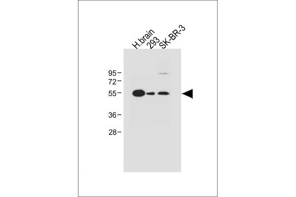 SPNS2 抗体  (N-Term)