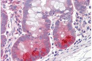 Anti-PKP3 / Plakophilin 3 antibody IHC staining of human small intestine. (Plakophilin 3 antibody  (AA 570-589))