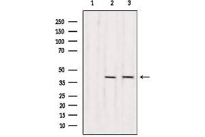 Western blot analysis of extracts from various samples, using RBM4 Antibody. (RBM4 antibody  (Internal Region))