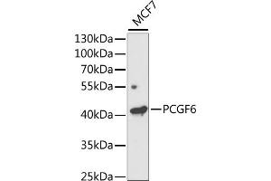 Western blot analysis of extracts of MCF7 cells, using PCGF6 antibody (ABIN6131076, ABIN6145311, ABIN6145312 and ABIN6221435) at 1:1000 dilution. (PCGF6 antibody  (AA 161-350))