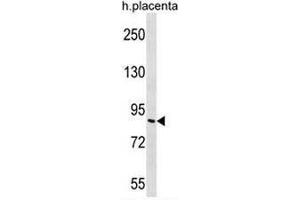GP111 Antibody (Center) western blot analysis in human placenta tissue lysates (35µg/lane). (GP111 antibody  (Middle Region))