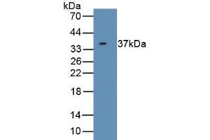 Detection of Recombinant CDK5, Human using Polyclonal Antibody to Cyclin Dependent Kinase 5 (CDK5) (CDK5 antibody  (AA 1-292))
