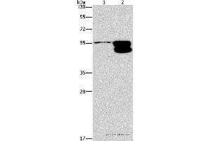 Western blot analysis of NIH/3T3 cell and mouse brain tissue, using CRHR2 Polyclonal Antibody at dilution of 1:650 (CRHR2 antibody)
