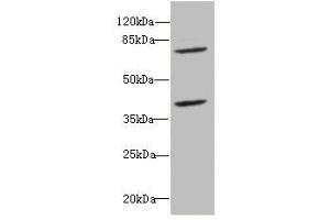 Western blot All lanes: CBFA2T2antibody at 2. (CBFA2T2 antibody  (AA 325-604))
