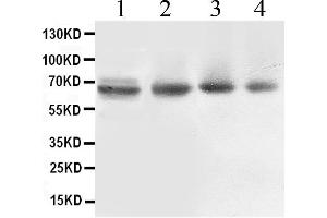Western blot analysis of ABCB10 expression in rat cardiac muscle extract ( Lane 1), COLO320 whole cell lysates ( Lane 2), 22RV1 whole cell lysates ( Lane 3) and PANC whole cell lysates ( Lane 4). (ABCB10 antibody  (C-Term))