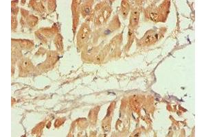 Immunohistochemistry of paraffin-embedded human heart tissue using ABIN7146531 at dilution of 1:100 (CAPNL1 antibody  (Catalytic Subunit))