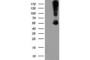 HEK293T cells were transfected with the pCMV6-ENTRY control (Left lane) or pCMV6-ENTRY CHN1 (Right lane) cDNA for 48 hrs and lysed. (CHN1 antibody)