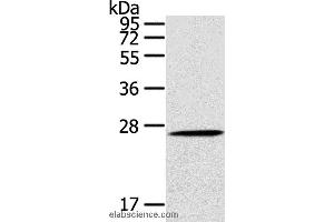 Western blot analysis of Mouse liver tissue, using CLEC4A Polyclonal Antibody at dilution of 1:100 (CLEC4A antibody)
