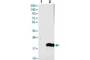 Western blot analysis of Lane 1: Negative control (vector only transfected HEK293T lysate), Lane 2: Over-expression Lysate (Co-expressed with a C-terminal myc-DDK tag (~3. (C14ORF177 antibody)