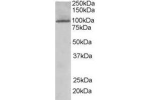 Image no. 2 for anti-TAO Kinase 3 (TAOK3) (Internal Region) antibody (ABIN374459)