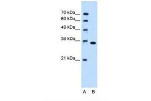 Image no. 1 for anti-Thymidylate Synthetase (TYMS) (C-Term) antibody (ABIN6738474) (TYMS antibody  (C-Term))