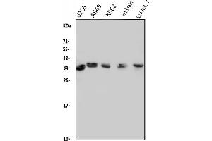 Western blot analysis of MED4 using anti-MED4 antibody (ABIN7600817). (MED4 antibody  (AA 24-254))