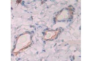Used in DAB staining on fromalin fixed paraffin- embedded Kidney tissue (WFDC5 antibody  (AA 1-123))