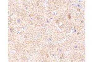 Immunohistochemistry of VISA in mouse brain tissue with this product at 2. (MAVS antibody  (Middle Region))